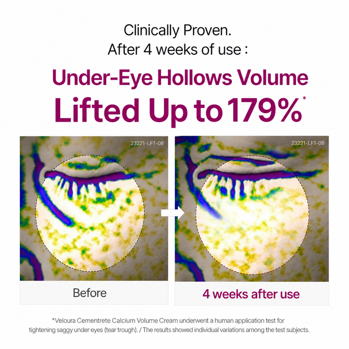 Cemenrete Calcium Eyecare Routine