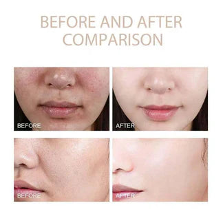 Veloura Glow RiceGlass Skin Premium Kit (6 pcs)™