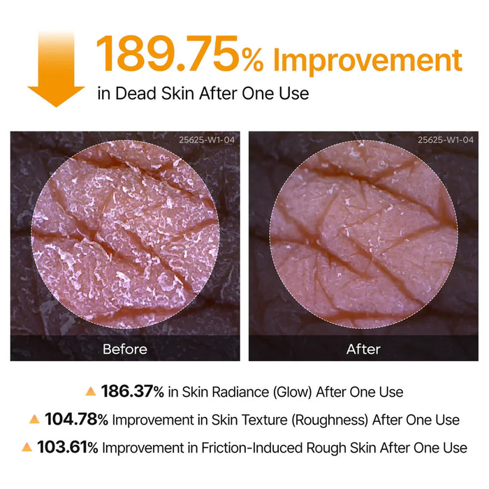 Glass Skin Renewal Kit (6 pcs) ™