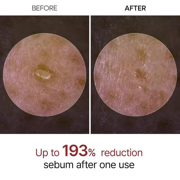 Veloura Rice Peel Ampoule